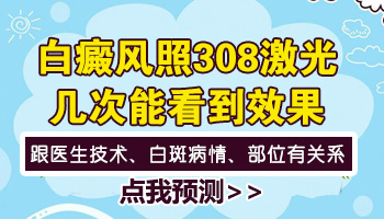 儿童脚部有白块照308好还是uvb效果好