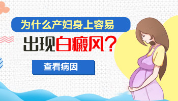 儿童头部有白斑怎么治疗有康复案例吗