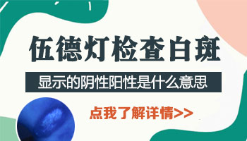 儿童额头有白斑进口308激光怎么治疗