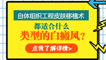 儿童头部长白癜风啥情况 怎么治疗