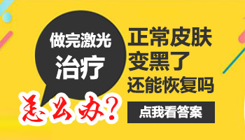 儿童肩膀长白癜风照308好还是uvb效果好