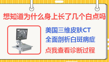 孩子身上长白点照uvb一次要多少钱