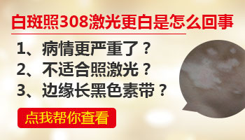 婴儿身上有鸡蛋大白斑只照308激光能好吗