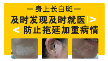 女性脸上长白点中西医结合治疗怎么样