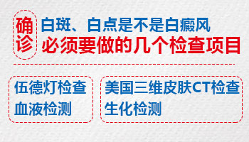 孩子身上有大面积白斑照308好还是uvb效果好