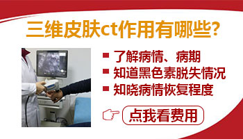 孩子脸上有一片白做308激光照多长时间最佳