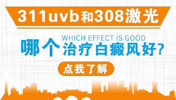 婴儿身上有片白照308激光多长久有好转