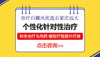 儿童脸上有大面积白斑只照uvb光能控制住吗