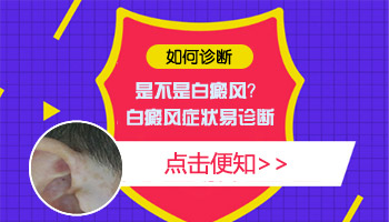 婴儿脸上有一片白只照uvb光能控制住吗