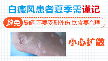 孩子身上有白点怎么治疗 有康复案例吗