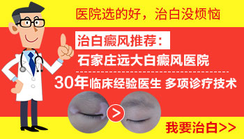 小孩身上有大面积白斑照308好还是uvb效果好