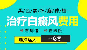 青少年脸上长硬币大白斑什么情况 如何治疗