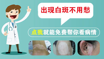 婴儿身上长白点多久照一次激光效果好