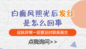 小孩身上长黄豆大白斑做308激光照多长时间最佳