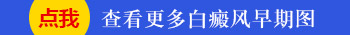 婴儿身上出现小白块照308激光2次不见效怎么办