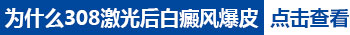 孩子身上长小白块做308激光照多长时间最佳