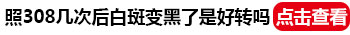 小孩身上有白斑照激光效果不明显怎么回事